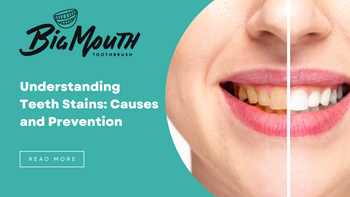 Understanding Teeth Stains: Causes and Prevention – BigMouthToothBrush